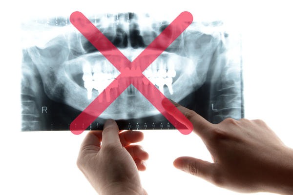 インプラント治療を断られた