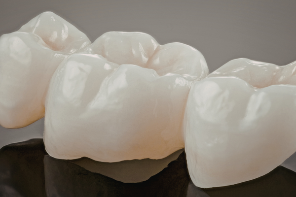 歯を削ってしまっている