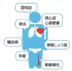 歯周病と全身疾患の関係